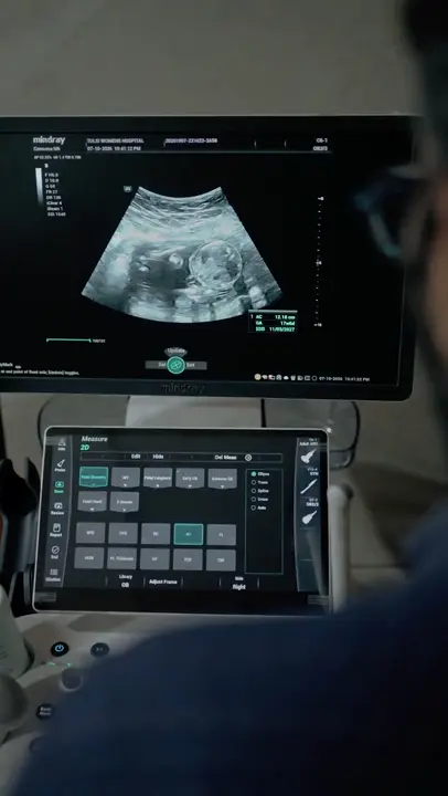 Ultrasound screen showing a pregnancy scan