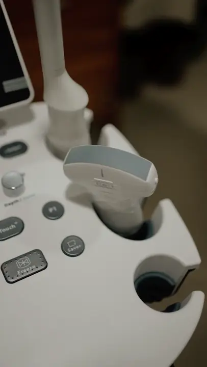 Close-up of the ultrasound machine and probe